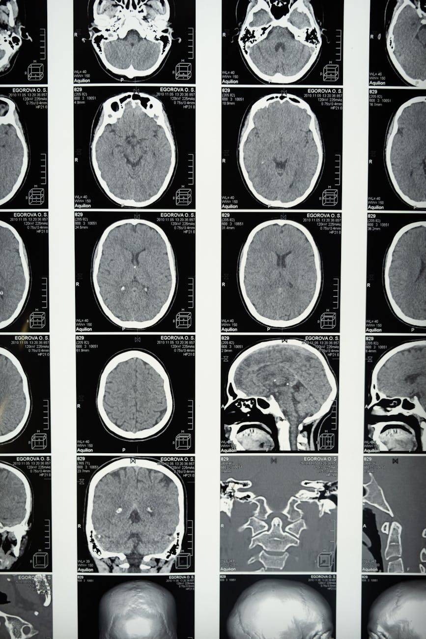 IMAGE: Brain scan illustration showing different areas lighting up during active listening, with labels like "Auditory Cortex", "Language Processing", and "Memory Encoding"